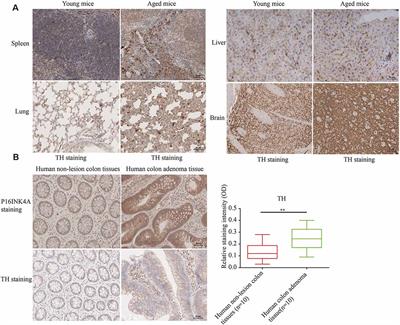 Senescent Cell-Secreted Netrin-1 Modulates Aging-Related Disorders by Recruiting Sympathetic Fibers
